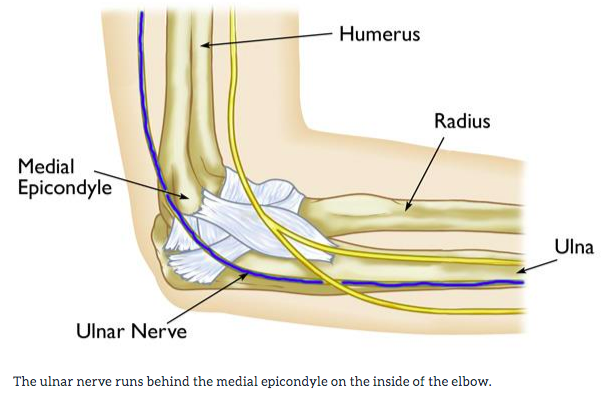 A pinched nerve in the elbow - Orthopedie Roeselare